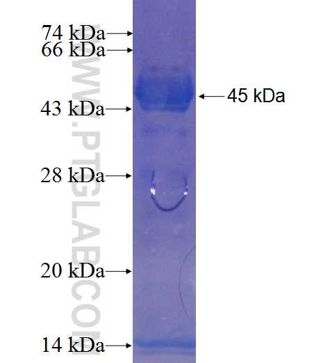 KIAA1274 fusion protein Ag23198 SDS-PAGE