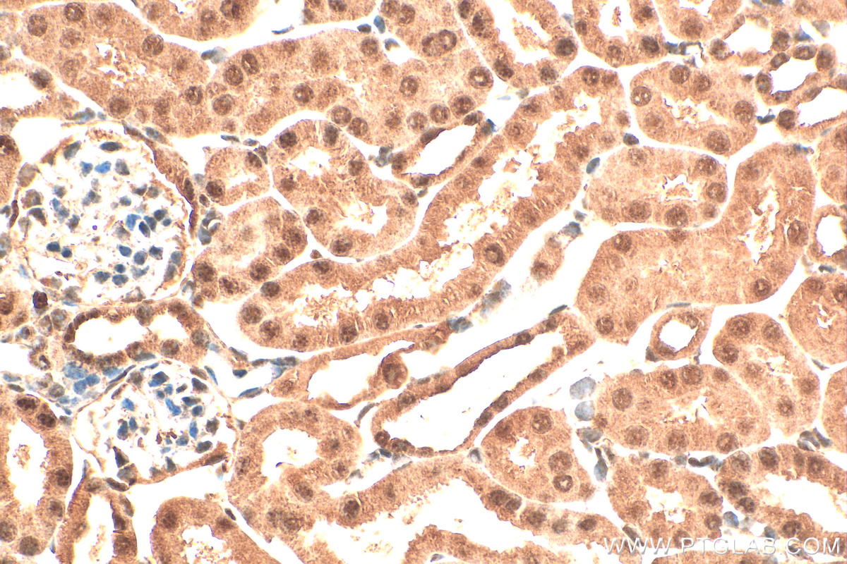 IHC staining of mouse kidney using 30166-1-AP