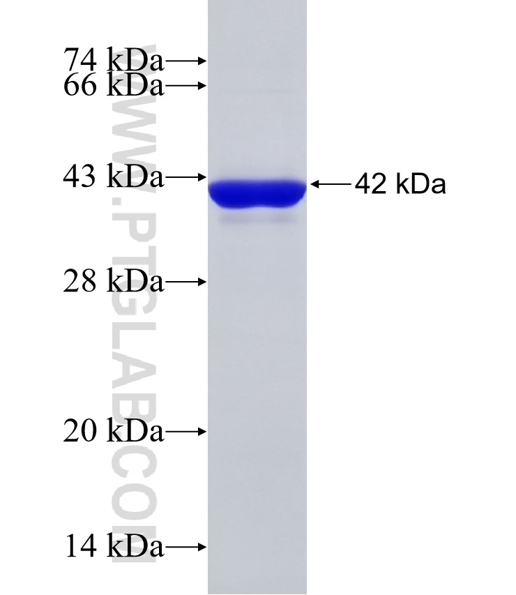 KIAA1429 fusion protein Ag32849 SDS-PAGE