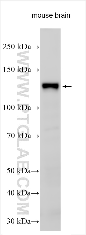 WB analysis using 18993-1-AP