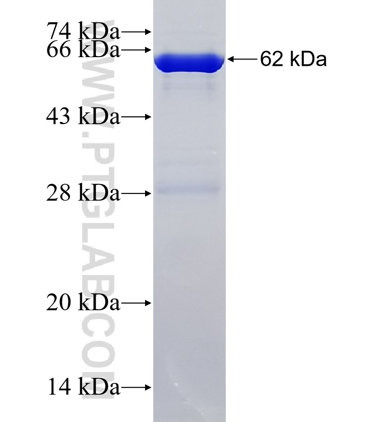 KIAA1586 fusion protein Ag36038 SDS-PAGE