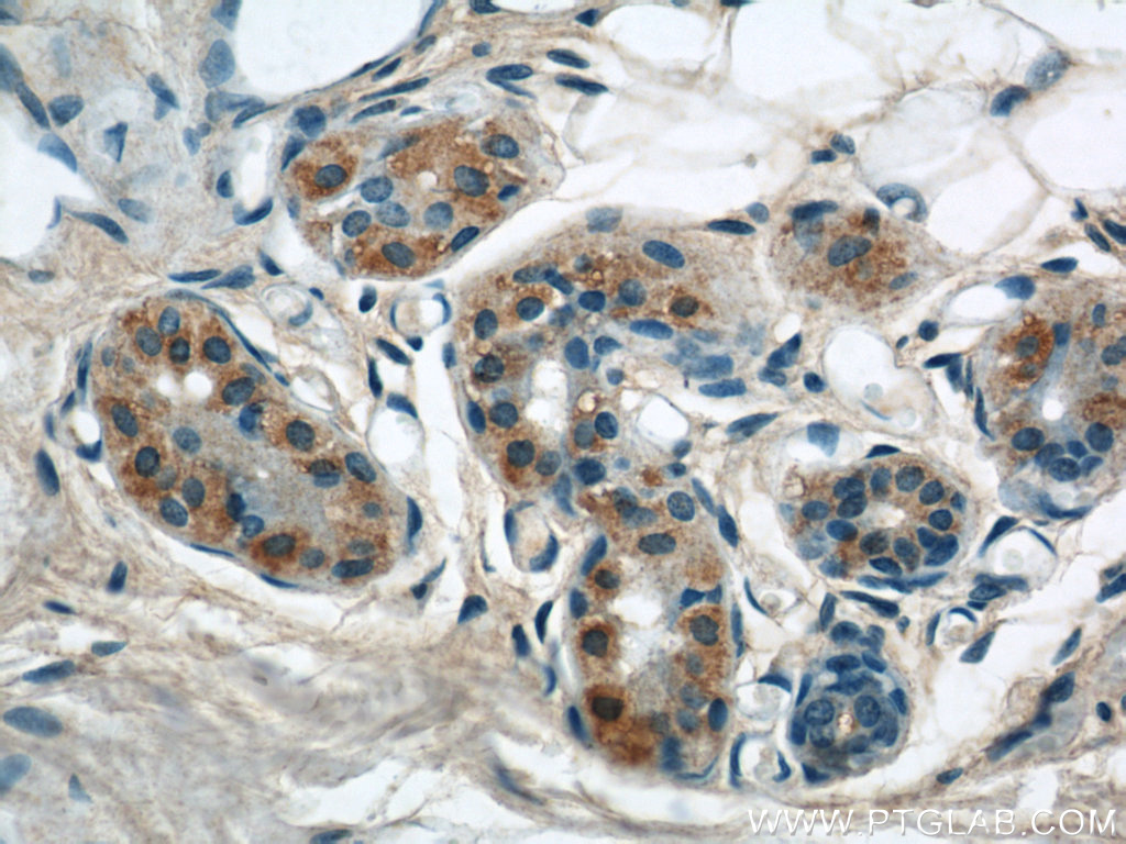 IHC staining of human skin using 21392-1-AP