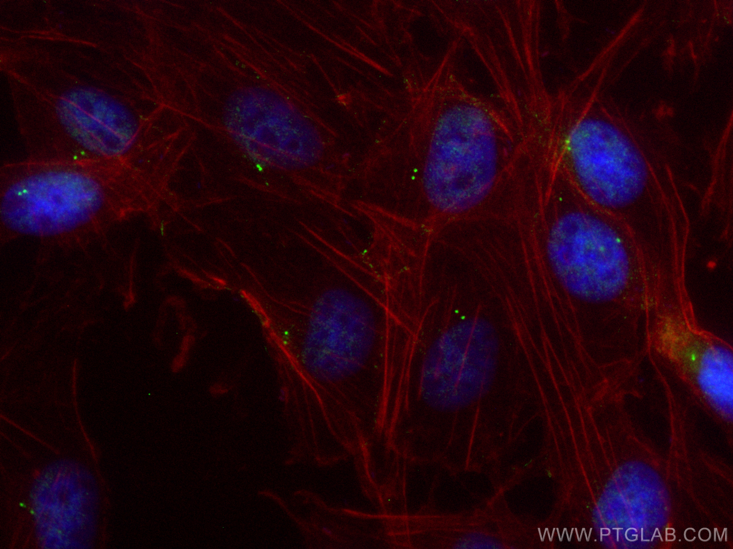 IF Staining of MDCK using 24457-1-AP