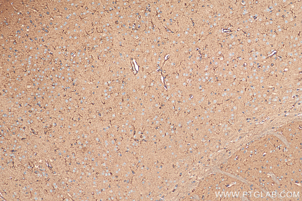 IHC staining of mouse brain using 24457-1-AP