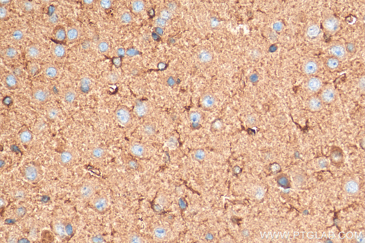 IHC staining of mouse brain using 24457-1-AP