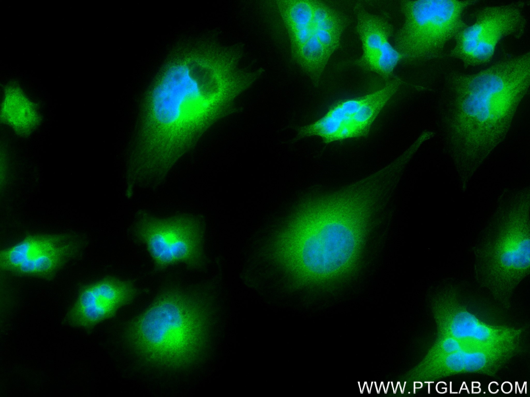 IF Staining of U-251 using 83418-5-RR