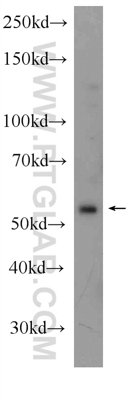 WB analysis of HeLa using 24395-1-AP