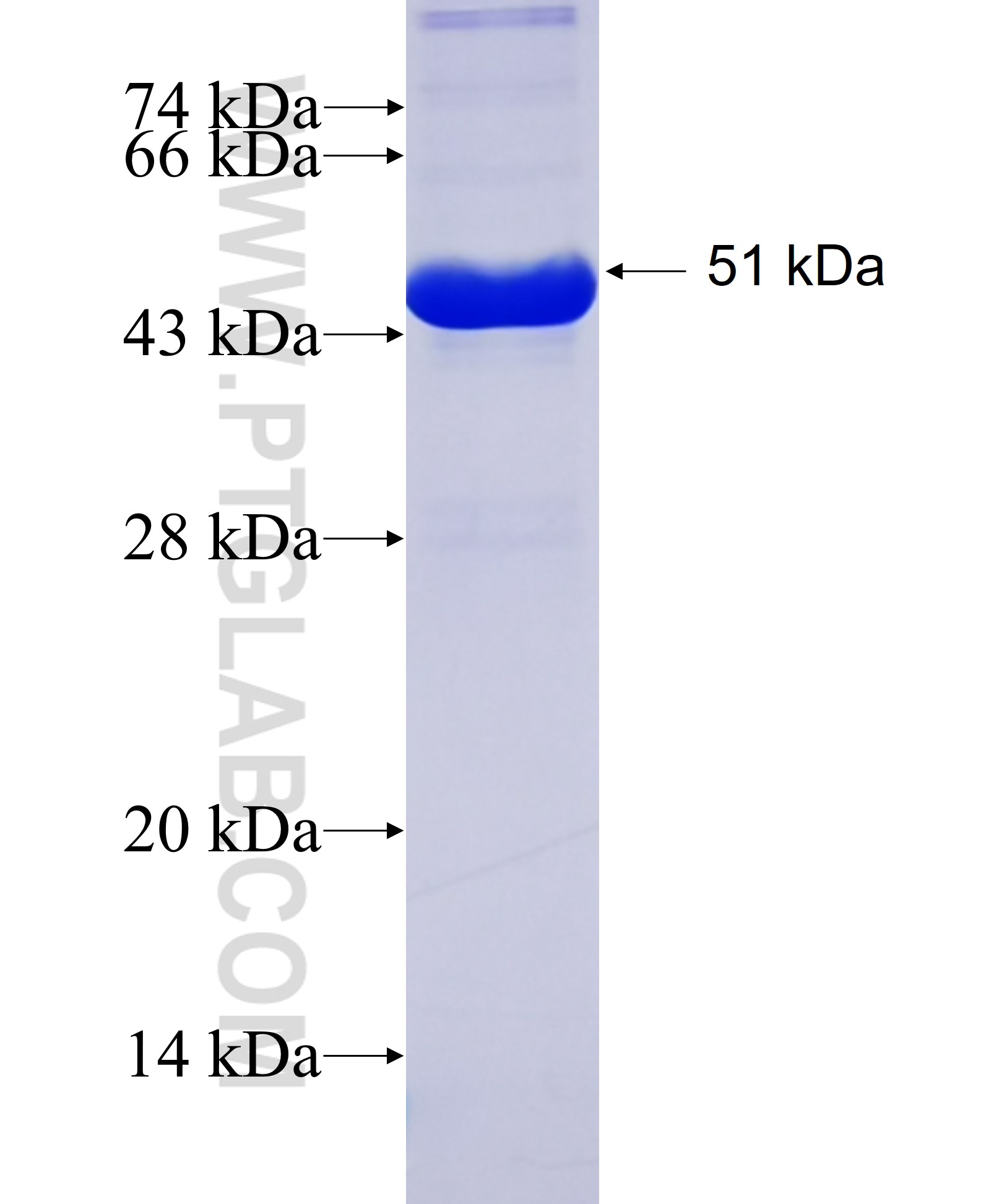 KIF11 fusion protein Ag20001 SDS-PAGE