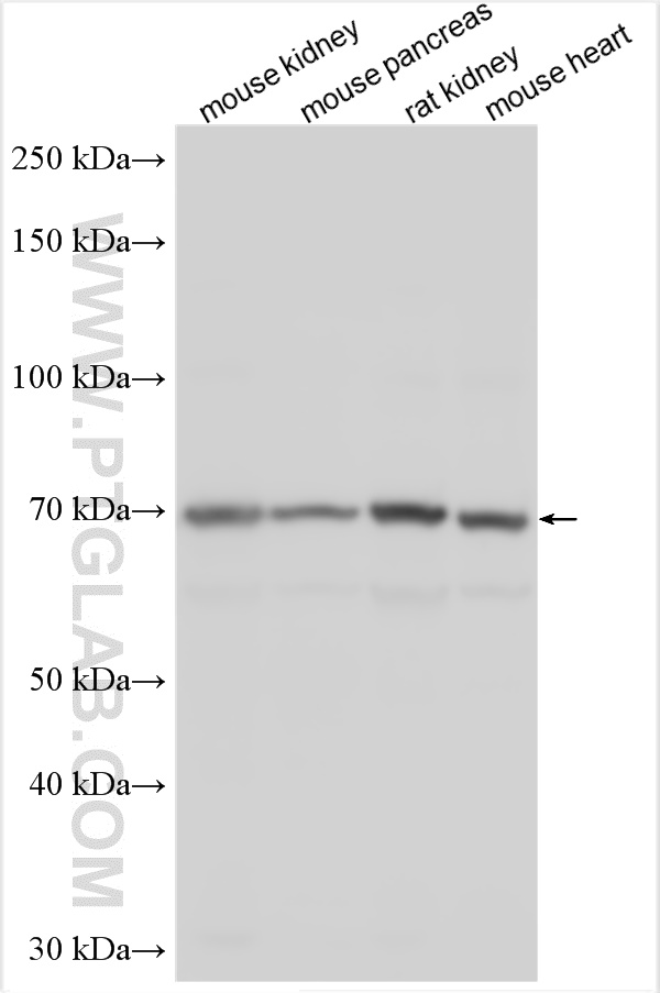 WB analysis using 12035-1-AP