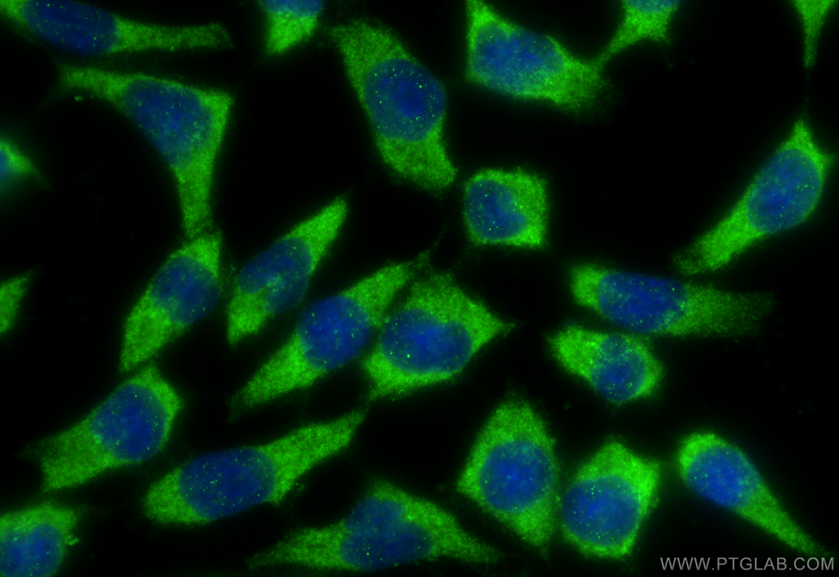 IF Staining of COS-7 using 14615-1-AP