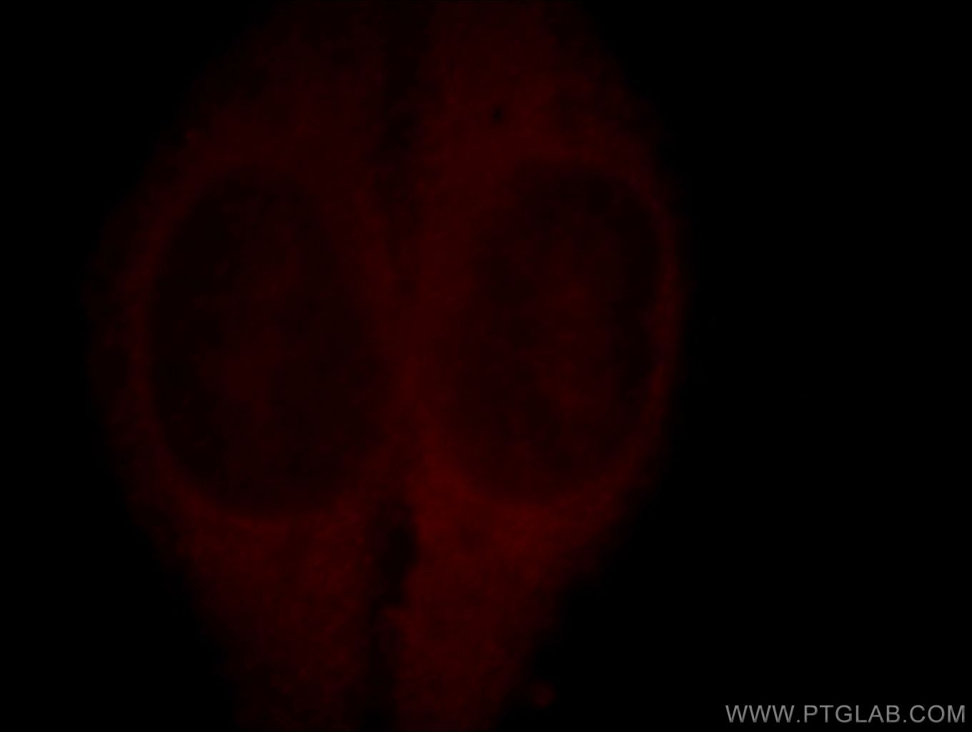 IF Staining of HepG2 using 19551-1-AP