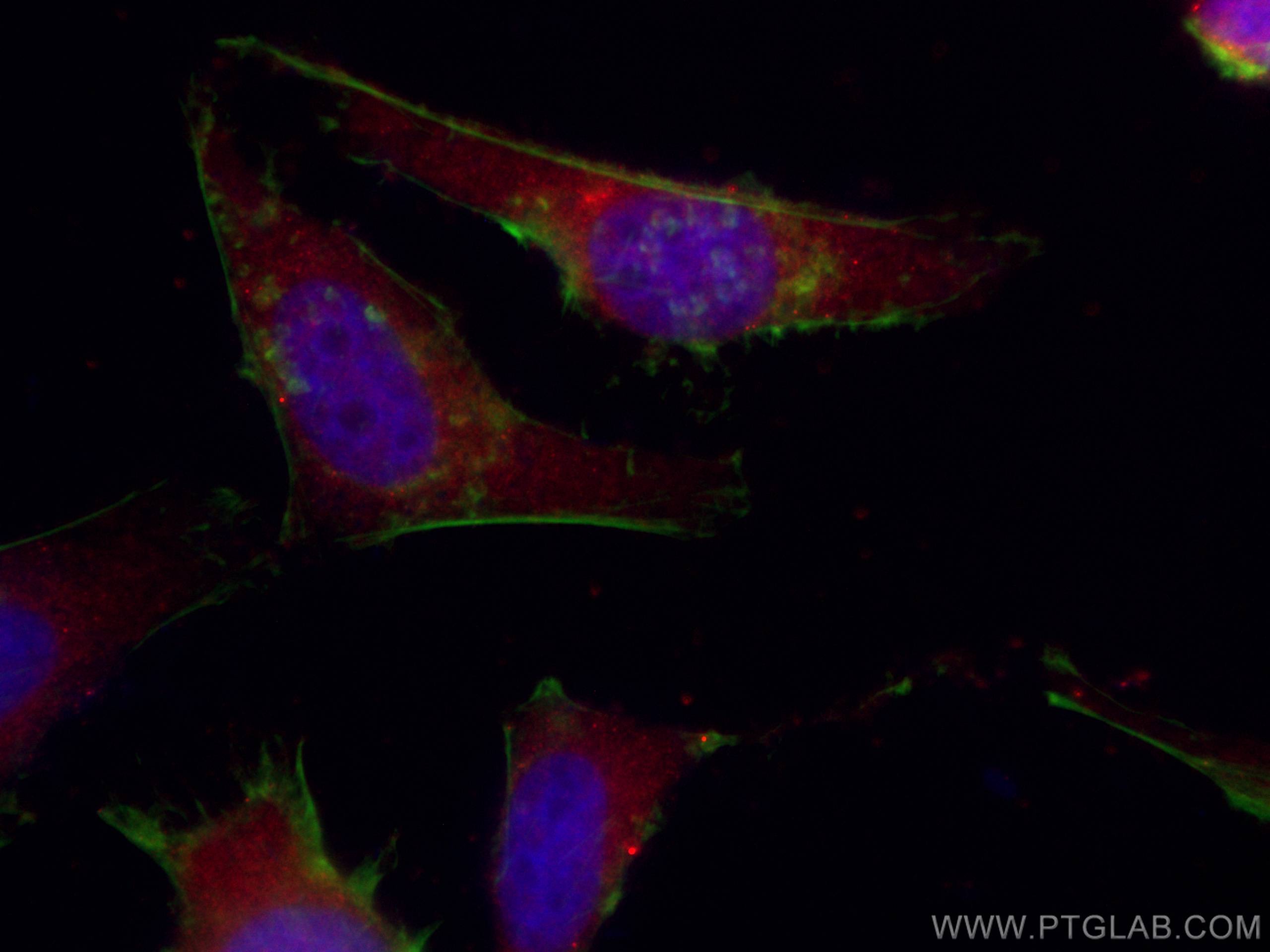 IF Staining of HeLa using CL594-67190