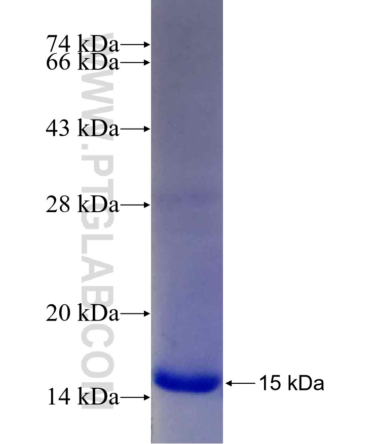 KIF21B fusion protein Ag22400 SDS-PAGE