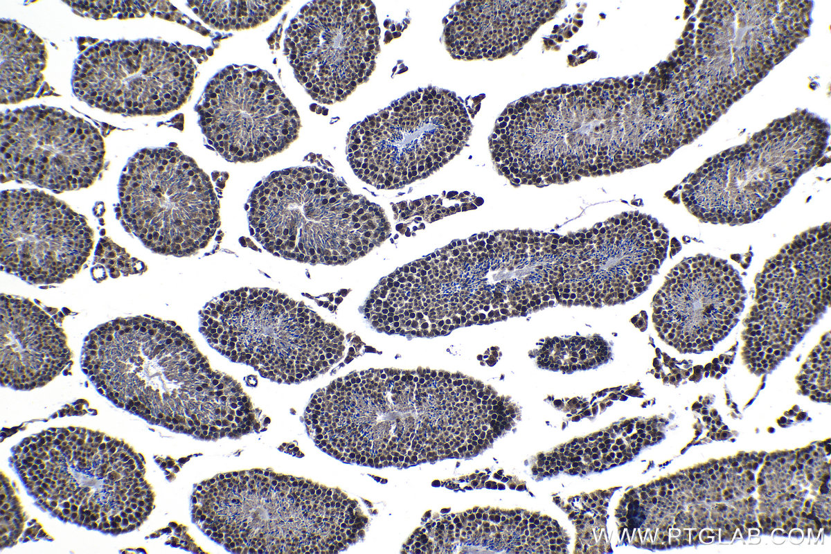 IHC staining of mouse testis using 13403-1-AP