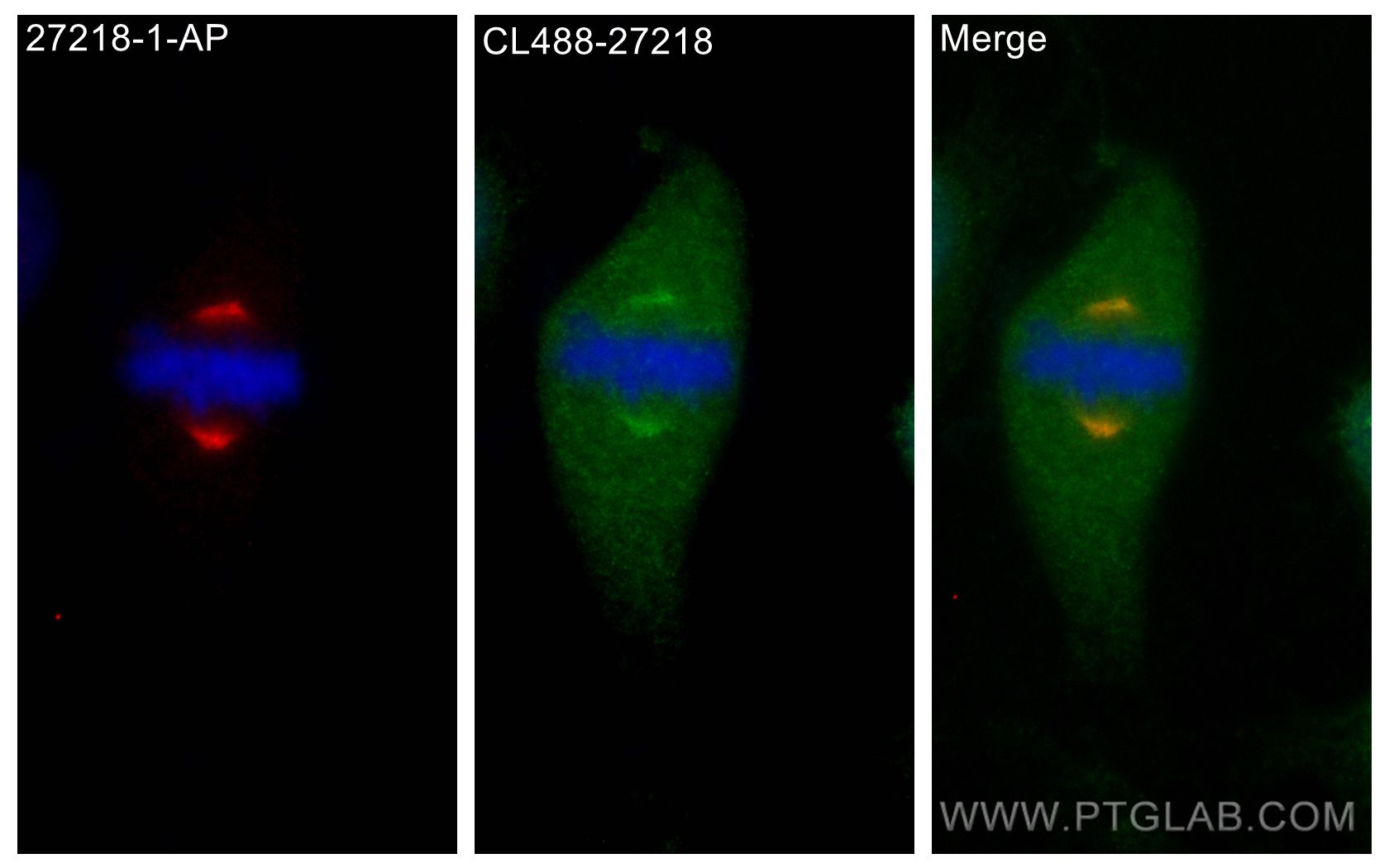 IF Staining of HeLa using CL488-27218