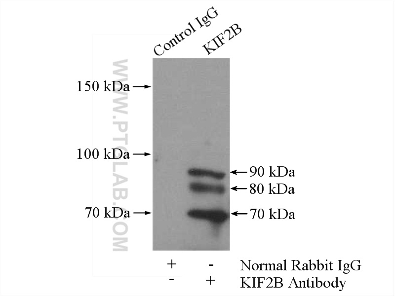 IP experiment of mouse testis using 13711-1-AP