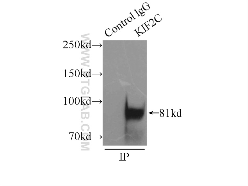 IP experiment of mouse testis using 12139-1-AP