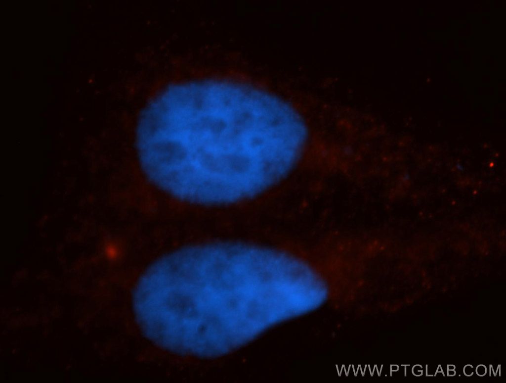 IF Staining of HepG2 using 14344-1-AP