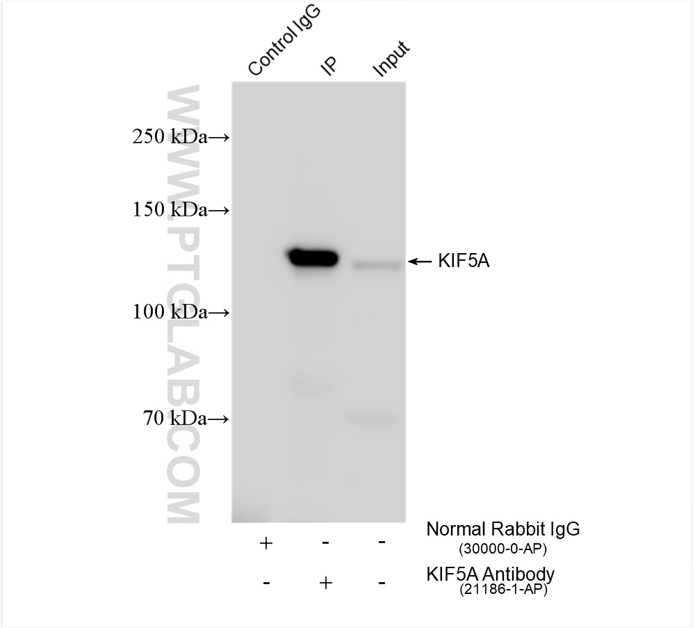 IP experiment of mouse brain using 21186-1-AP