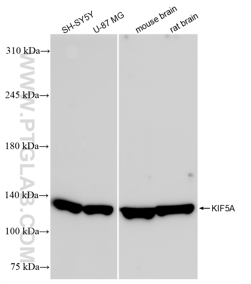 WB analysis of rat brain using 84013-4-RR