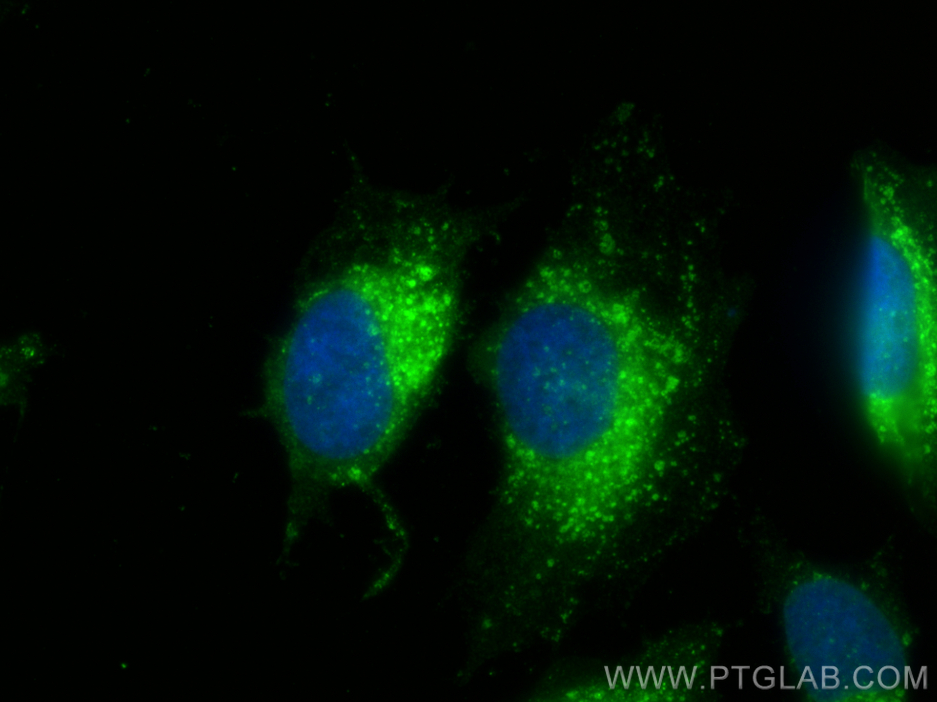 IF Staining of HeLa using 25897-1-AP