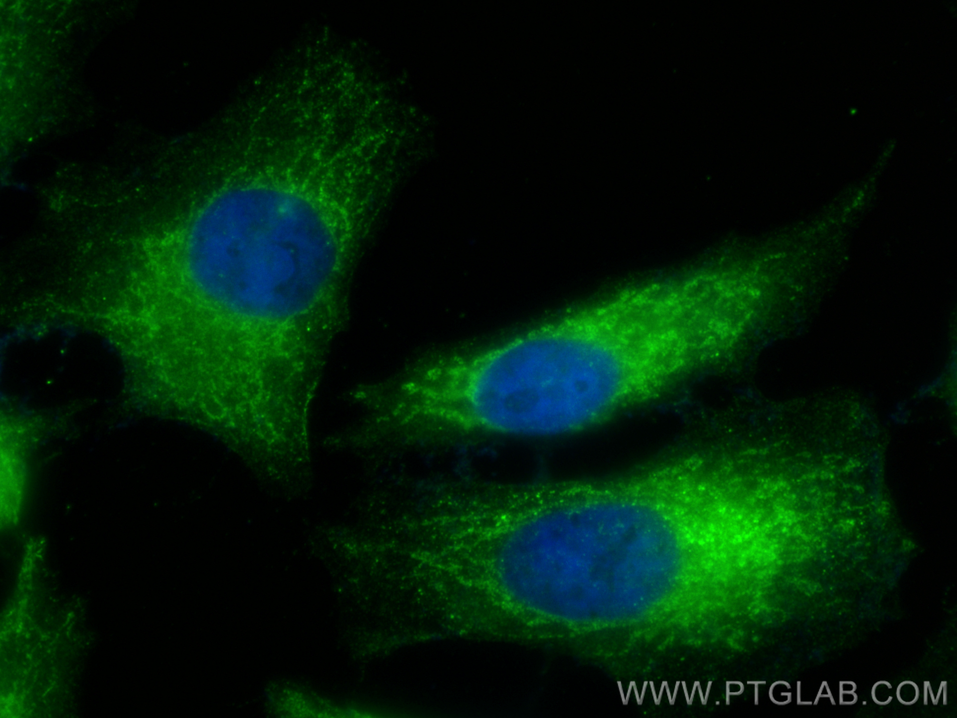 IF Staining of HeLa using 25897-1-AP