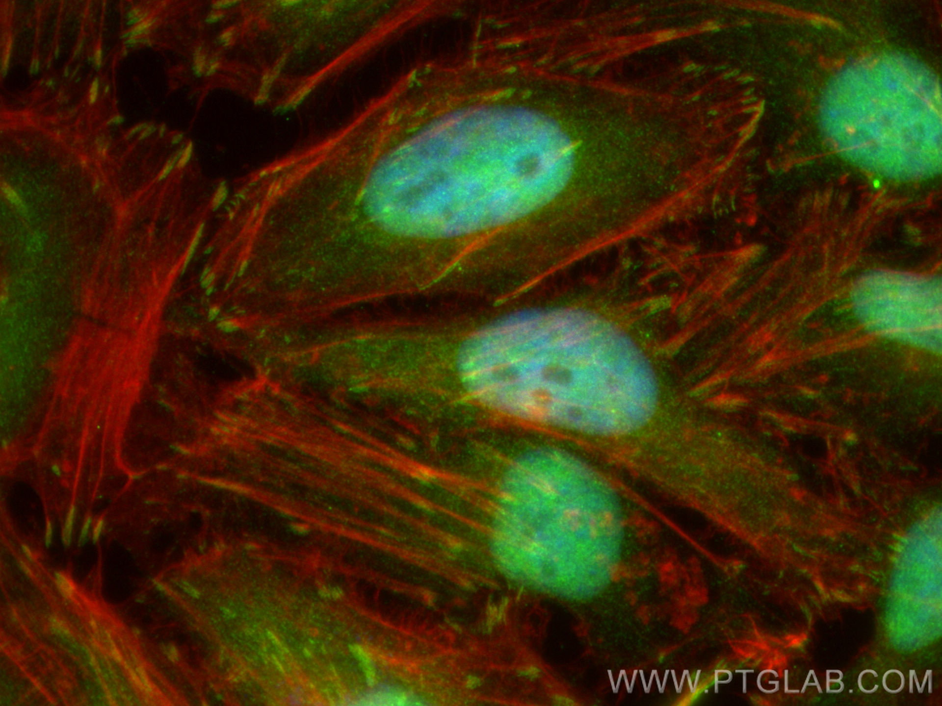 IF Staining of HeLa using 12313-1-AP