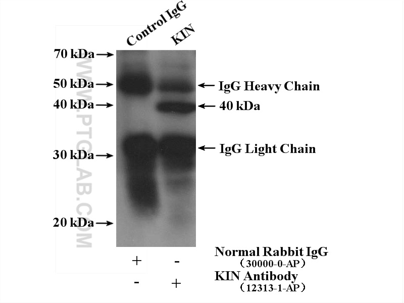 IP experiment of mouse brain using 12313-1-AP