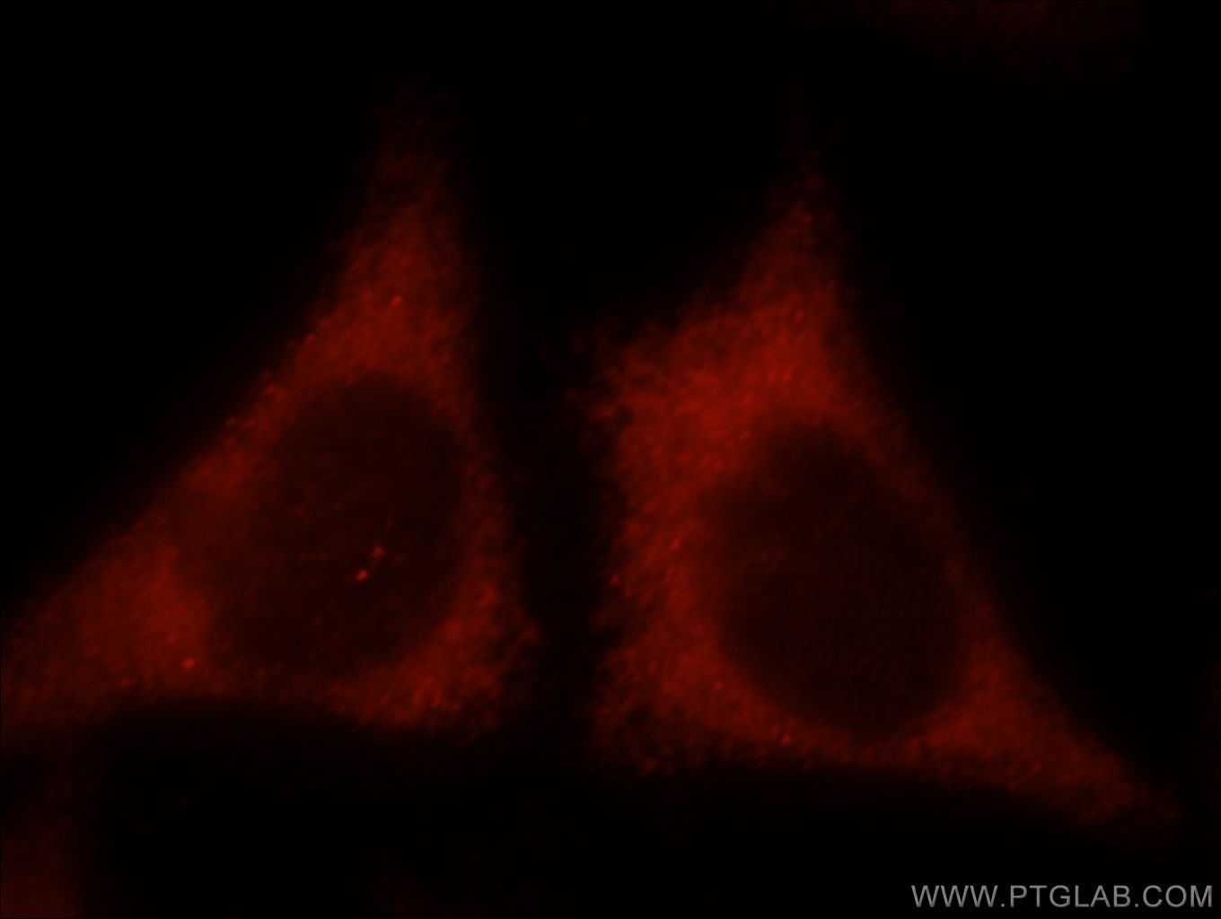 IF Staining of HepG2 using 21152-1-AP