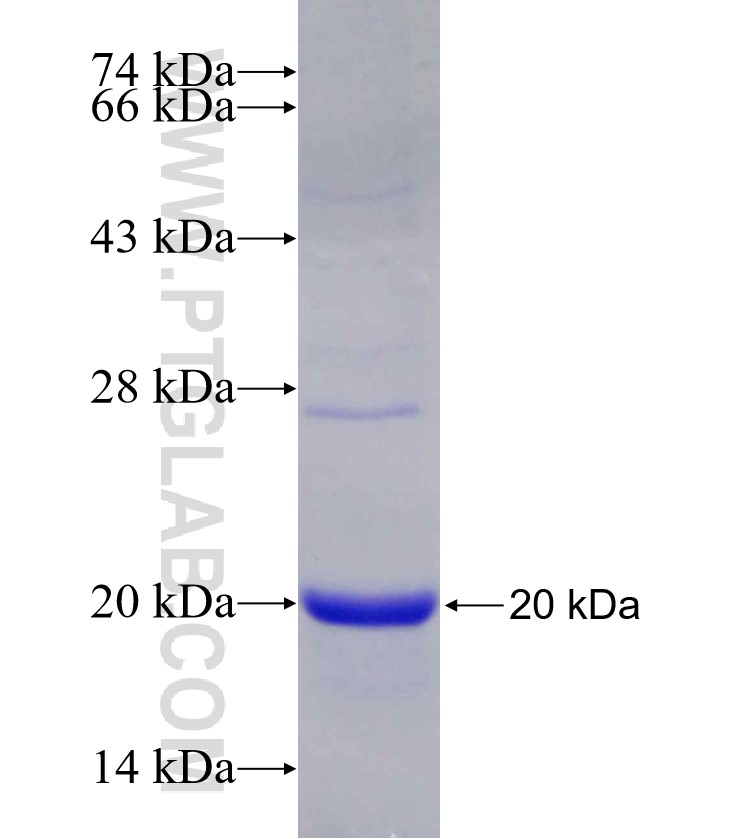 KISS1 fusion protein Ag27198 SDS-PAGE