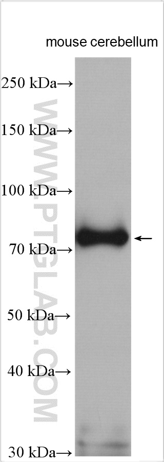 WB analysis of mouse cerebellum using 15505-1-AP