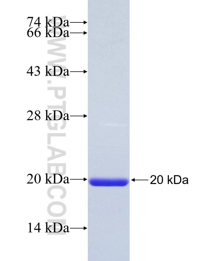 KL fusion protein Ag27838 SDS-PAGE