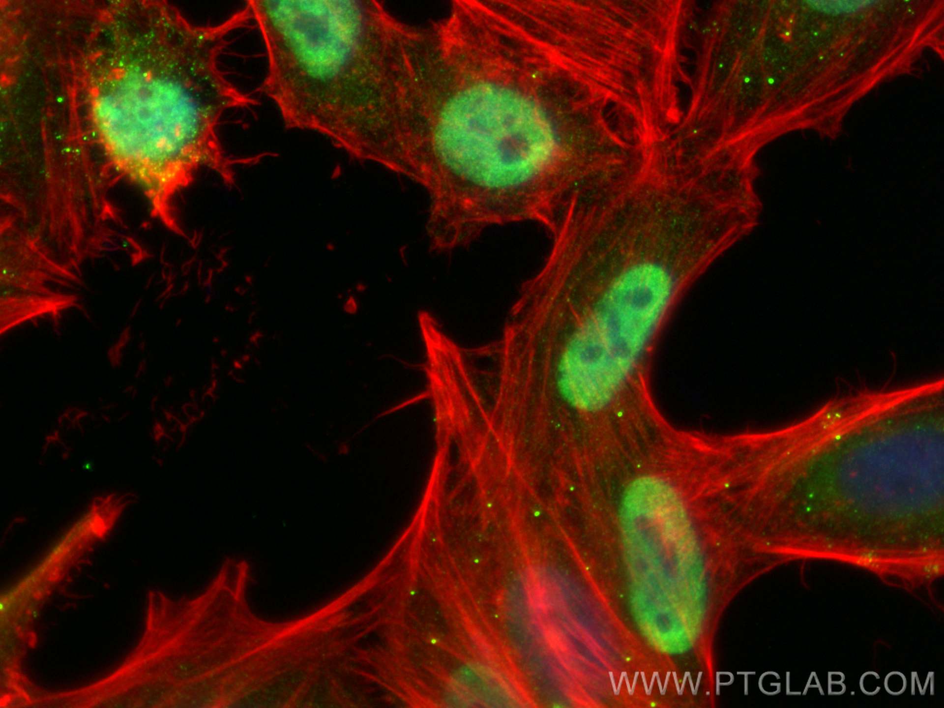 IF Staining of HepG2 using 66185-1-Ig (same clone as 66185-1-PBS)