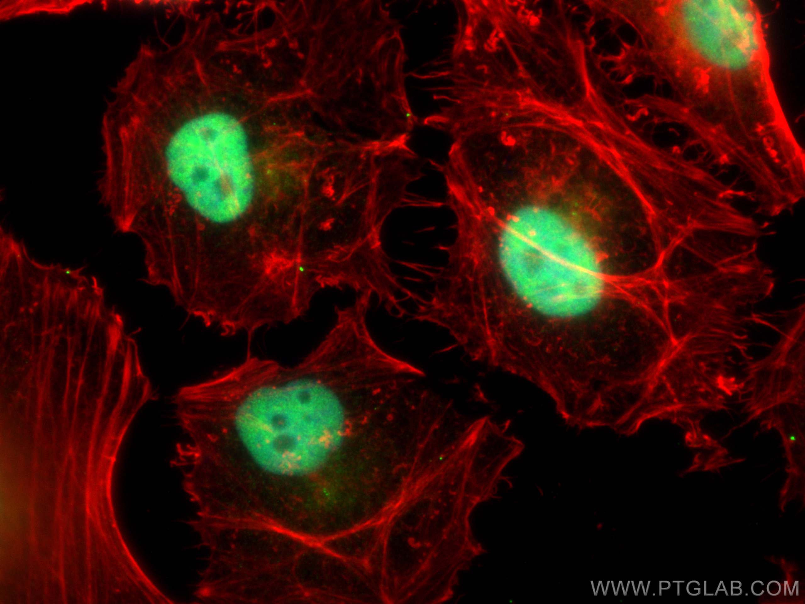 IF Staining of HeLa using 21017-1-AP