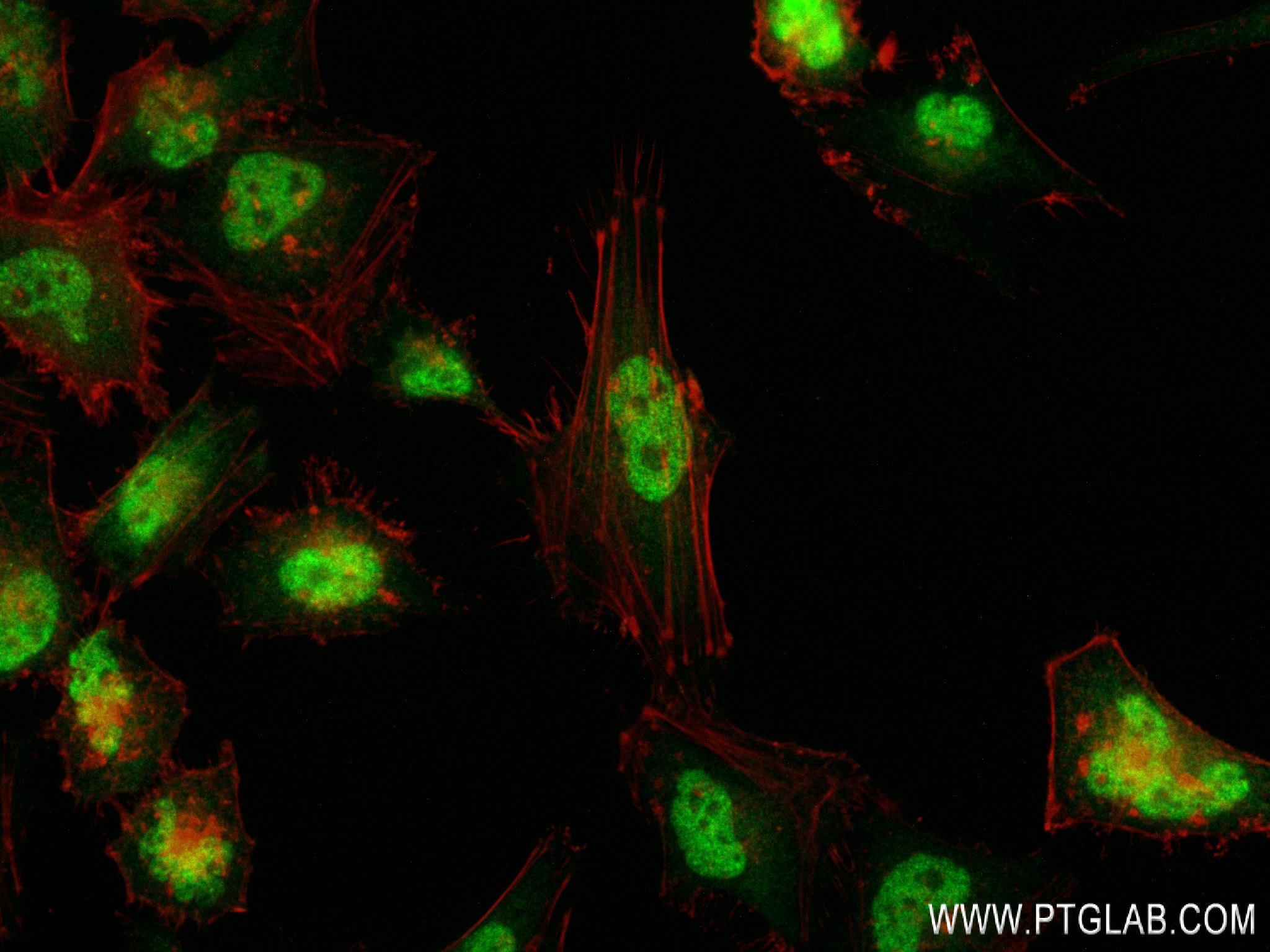 IF Staining of HeLa using 83205-4-RR (same clone as 83205-4-PBS)
