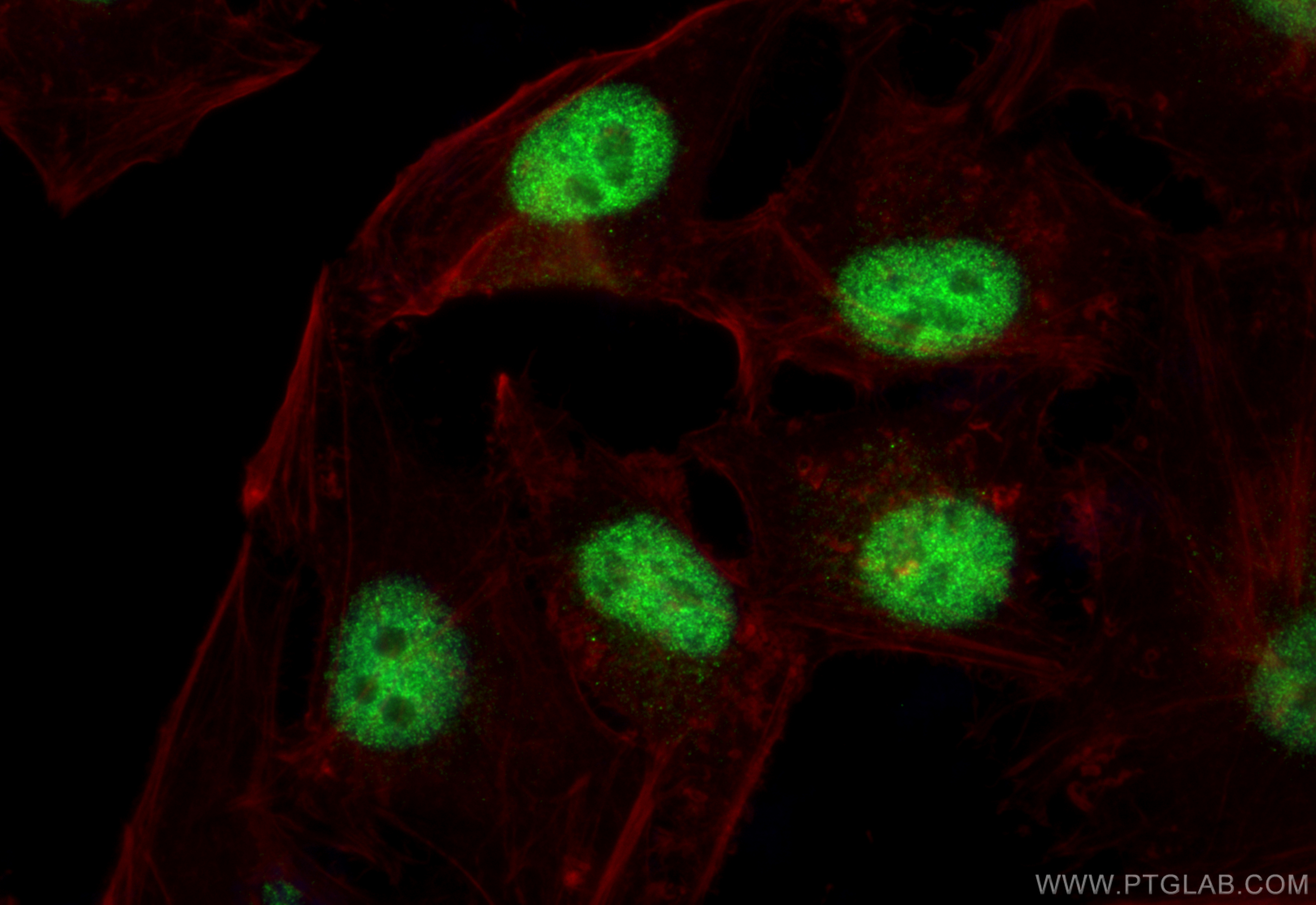 IF Staining of HeLa using 83205-4-RR