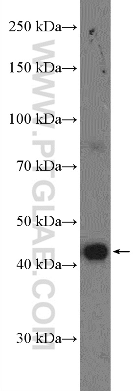 WB analysis of HeLa using 27277-1-AP