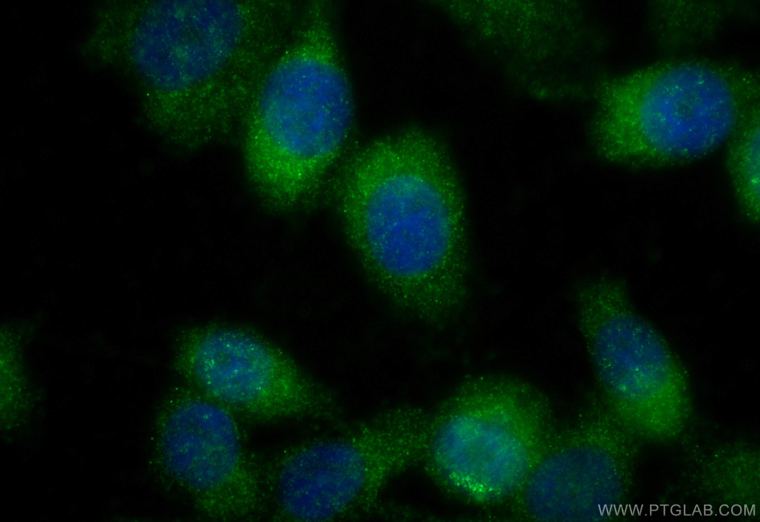 IF Staining of PC-3 using 13905-1-AP