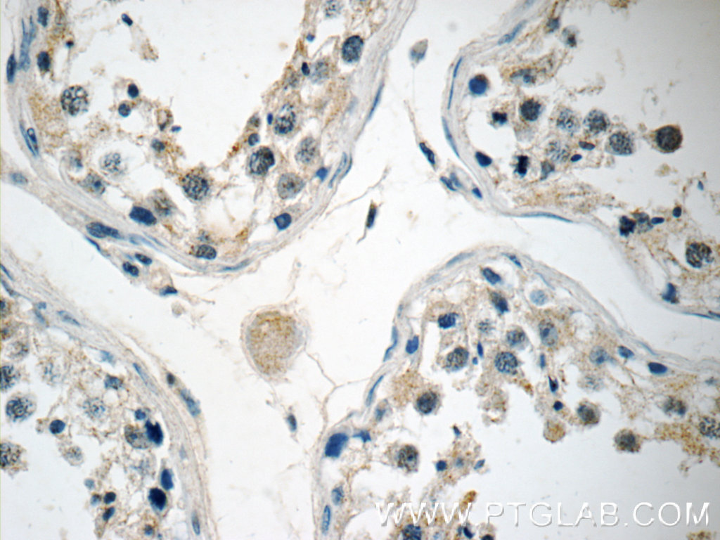 IHC staining of human testis using 13905-1-AP