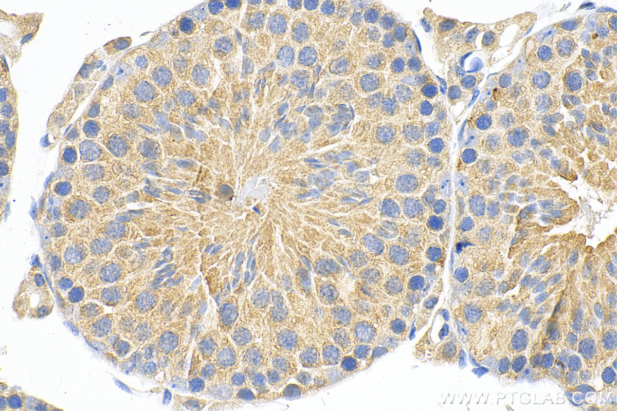 IHC staining of mouse testis using 13905-1-AP