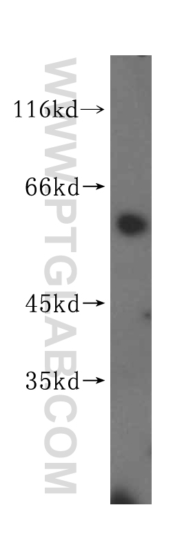 WB analysis of mouse thymus using 16915-1-AP