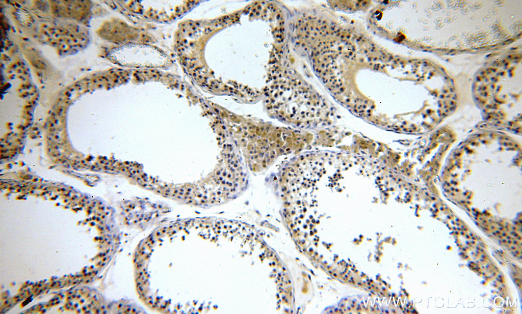 IHC staining of human testis using 14883-1-AP