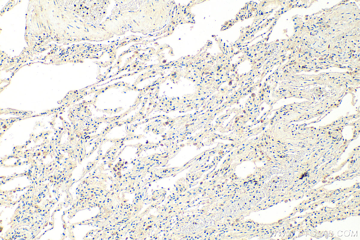 IHC staining of human lung using 15612-1-AP