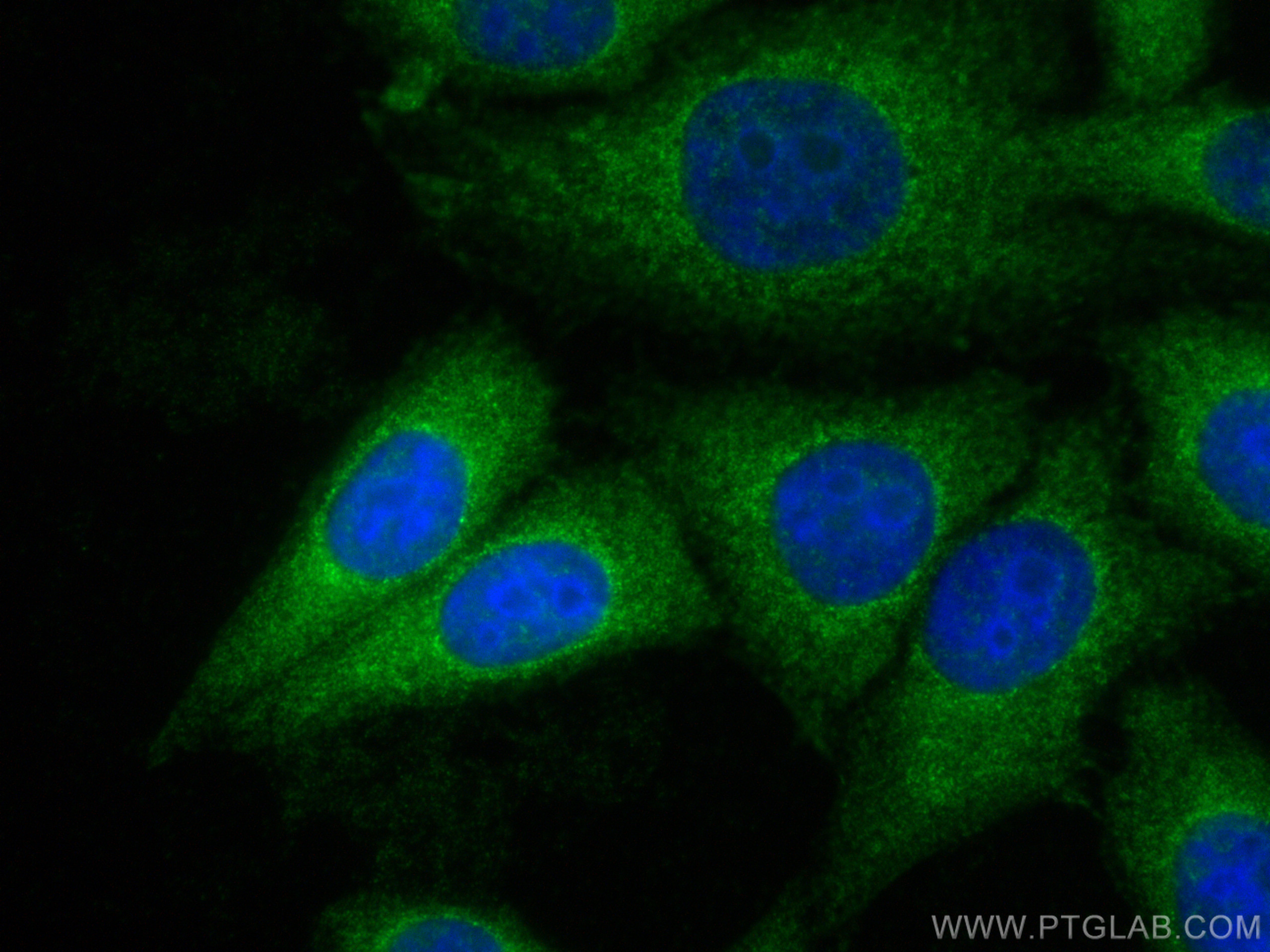 IF Staining of HepG2 using 29253-1-AP