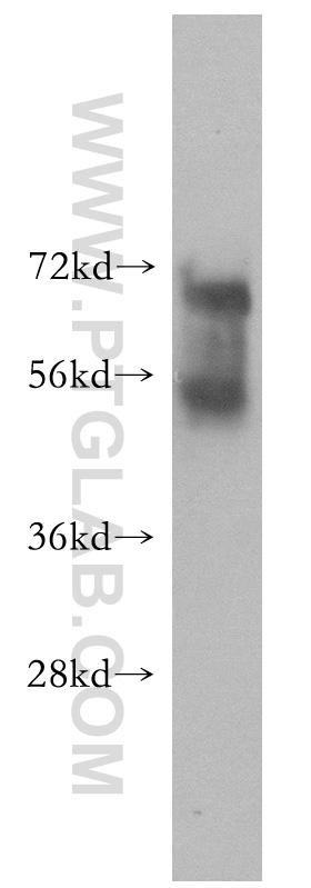 WB analysis of HEK-293 using 51131-1-AP