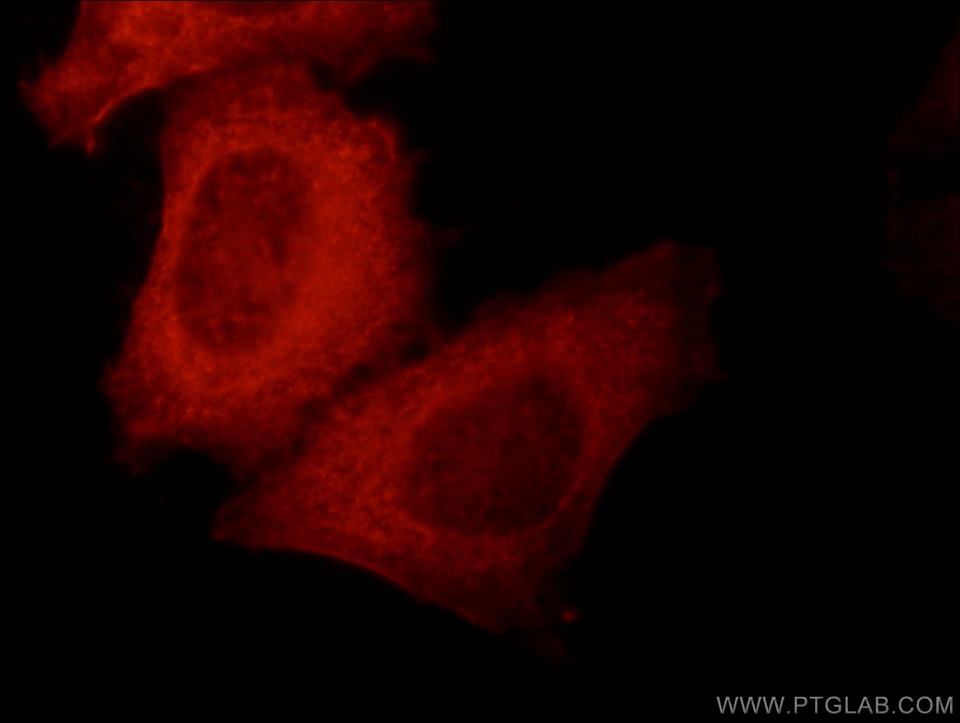 IF Staining of HepG2 using 14849-1-AP