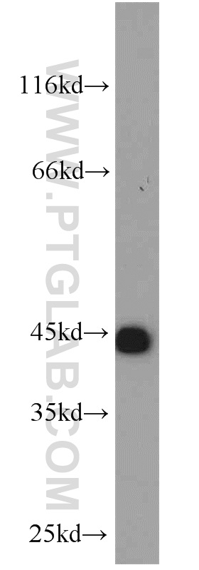 WB analysis of HeLa using 14849-1-AP