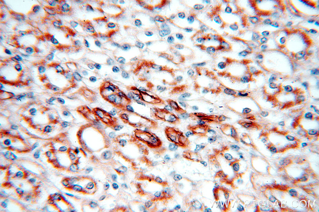 IHC staining of human kidney using 18111-1-AP