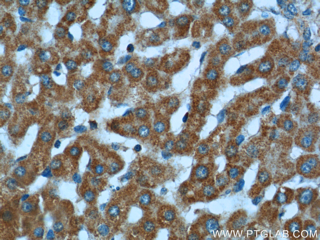 IHC staining of human liver using 25224-1-AP