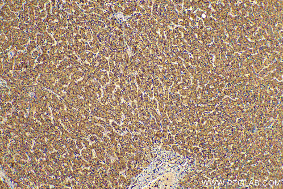 IHC staining of human liver using 25224-1-AP